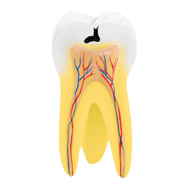 Model zubu stolička se dvěma kořeny 2dílný - Anatomické modely physa